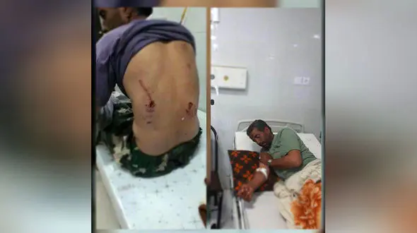 برای چندمین بار خرس به یک مرد در ایذه‌ حمله کرد +عکس