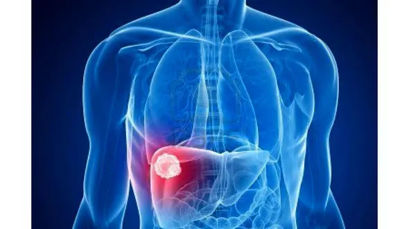 8 نشانه کبد سمی