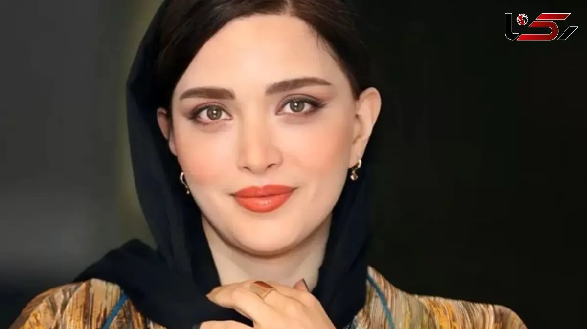 چهره بهنوش طباطبایی در عجیب ترین حالت ممکن/ عکس