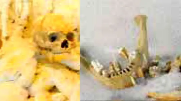 کشف اسکلت های 7 هزار ساله