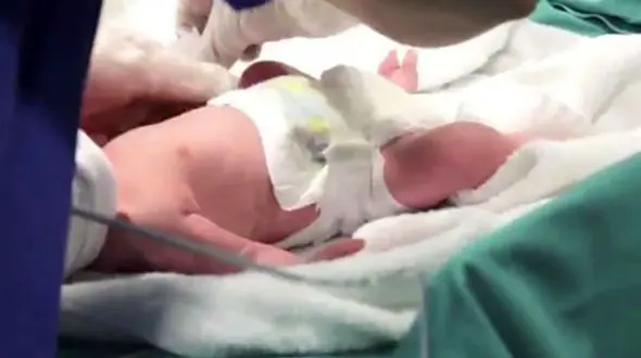 زن 64 ساله دو قلو بدنیا آورد +عکس