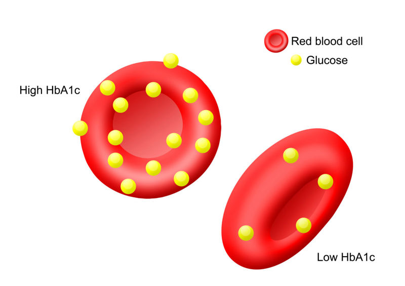 تحلیل آزمایش HbA1c