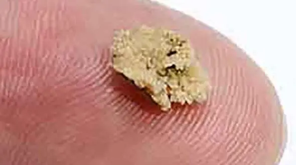 این روغن را بمالید سنگ کلیه دفع می شود! + جزییات