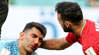آخرین خبر از علیرضا بیرانوند / او جام جهانی را از دست داد؟ 