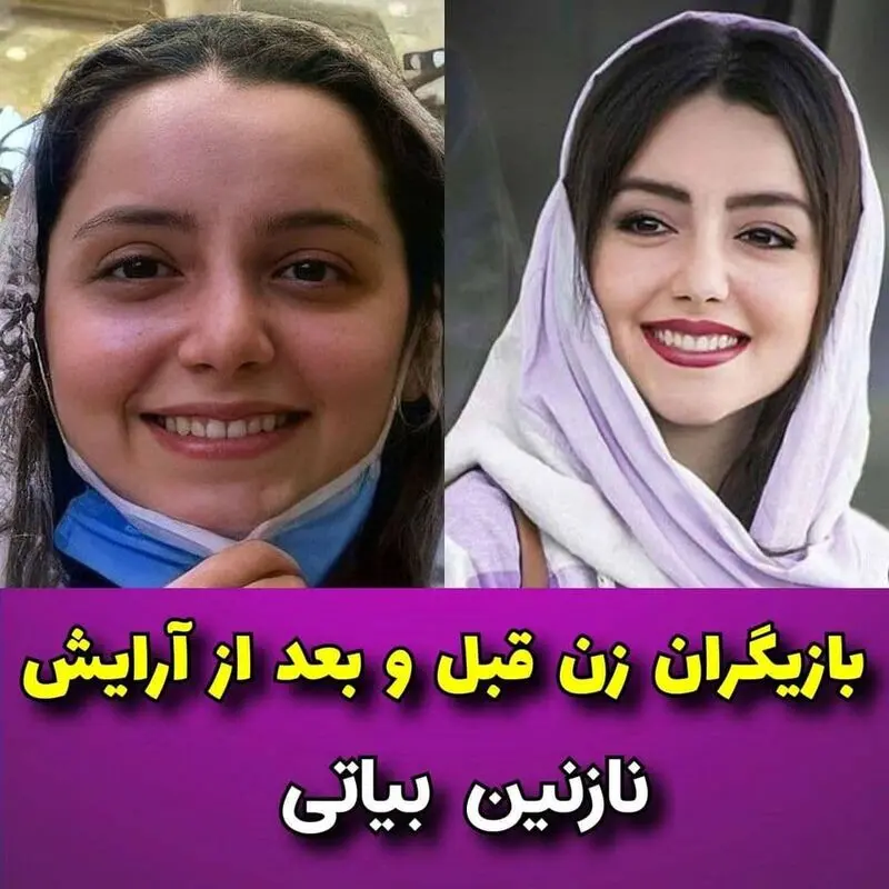 بازیگران زن بدون آرایش