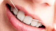 نخ دندان ایمن تر است یا خلال دندان؟