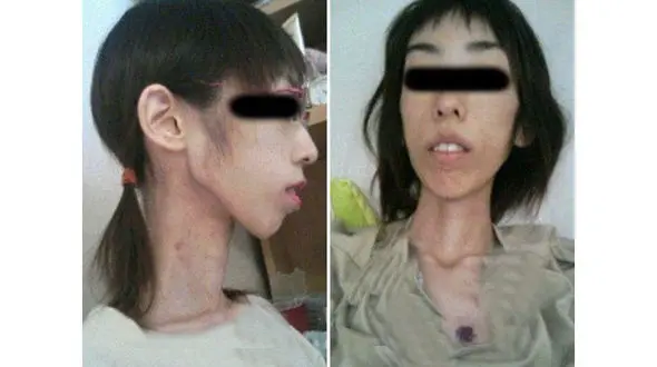 بلای وحشتناکی که در خانه پدربزرگ بر سر دختر تنها آمد + عکس آثار شکنجه هولناک