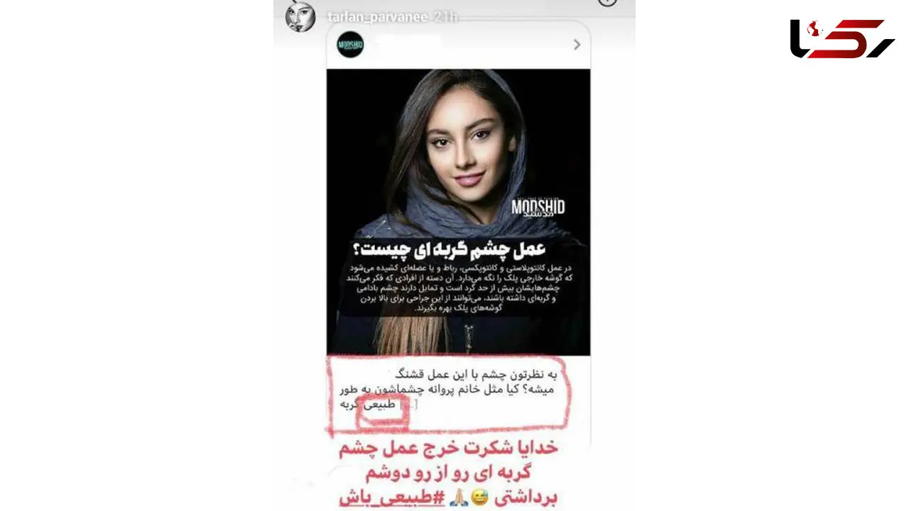 عمل چشم گربه ای خانم بازیگر از شایعه تا واقعیت! +عکس 