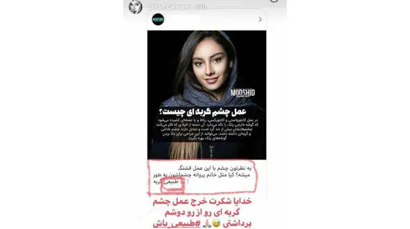 عمل چشم گربه ای خانم بازیگر از شایعه تا واقعیت! +عکس 