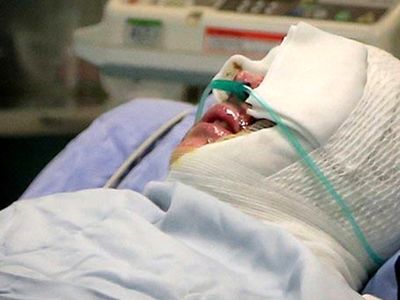 اسید پاشی  روی صورت خانم ناظم مدرسه درکرج ! / داخل مدرسه رخ داد
