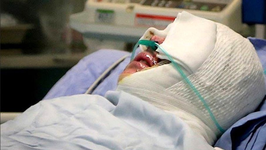 شاکی دریادل از قصاص گذشت / آزادی زن اسیدپاش پس از سال‌ها زندان + فیلم اظهارات قربانی