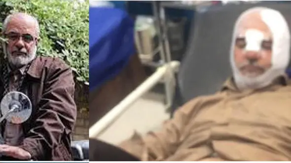 اولین عکس حسین‌ الله‌کرم پس از تصادف مشکوک در بیمارستان