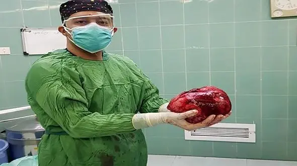 این دختر 20 ساله زاهدانی با یک توده کم نظیر در بدنش زندگی می کرد + عکس ها