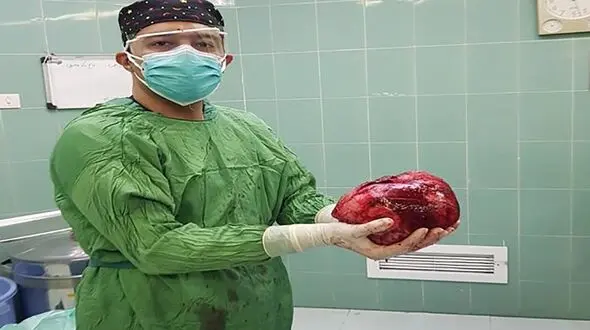 این دختر 20 ساله زاهدانی با یک توده کم نظیر در بدنش زندگی می کرد + عکس ها