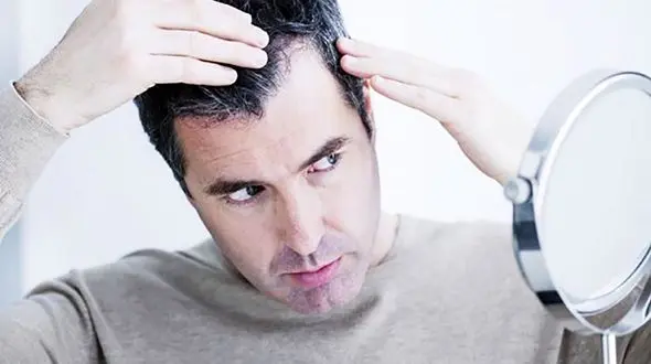 نسخه طلایی برای مهار سفیدی زودرس موی سر