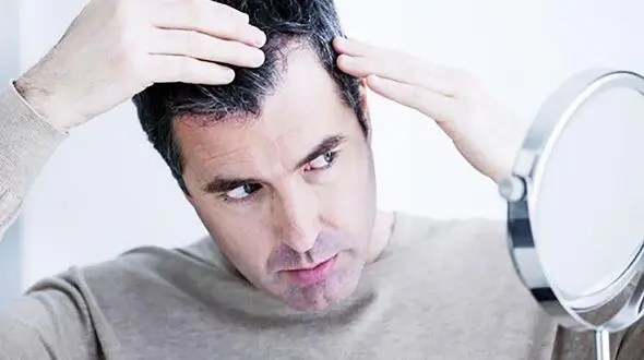 نسخه طلایی برای مهار سفیدی زودرس موی سر