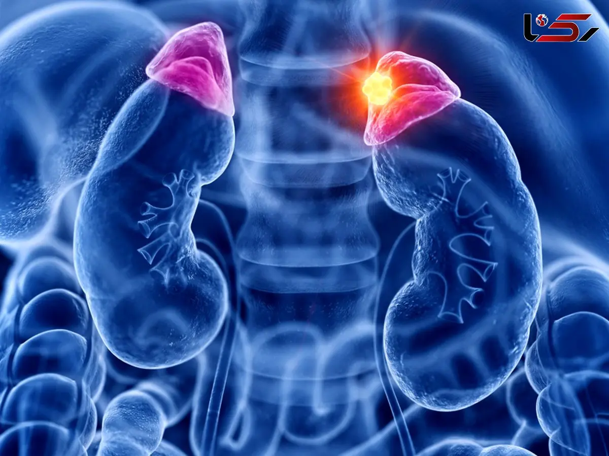 کورتیزول چیست؟ / 7 جدول مهم و مفید درباره کورتیزول 