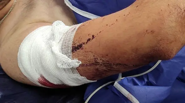 یک دانشجوی دیگر قربانی زورگیری شد/ در گلستان رخ داد!