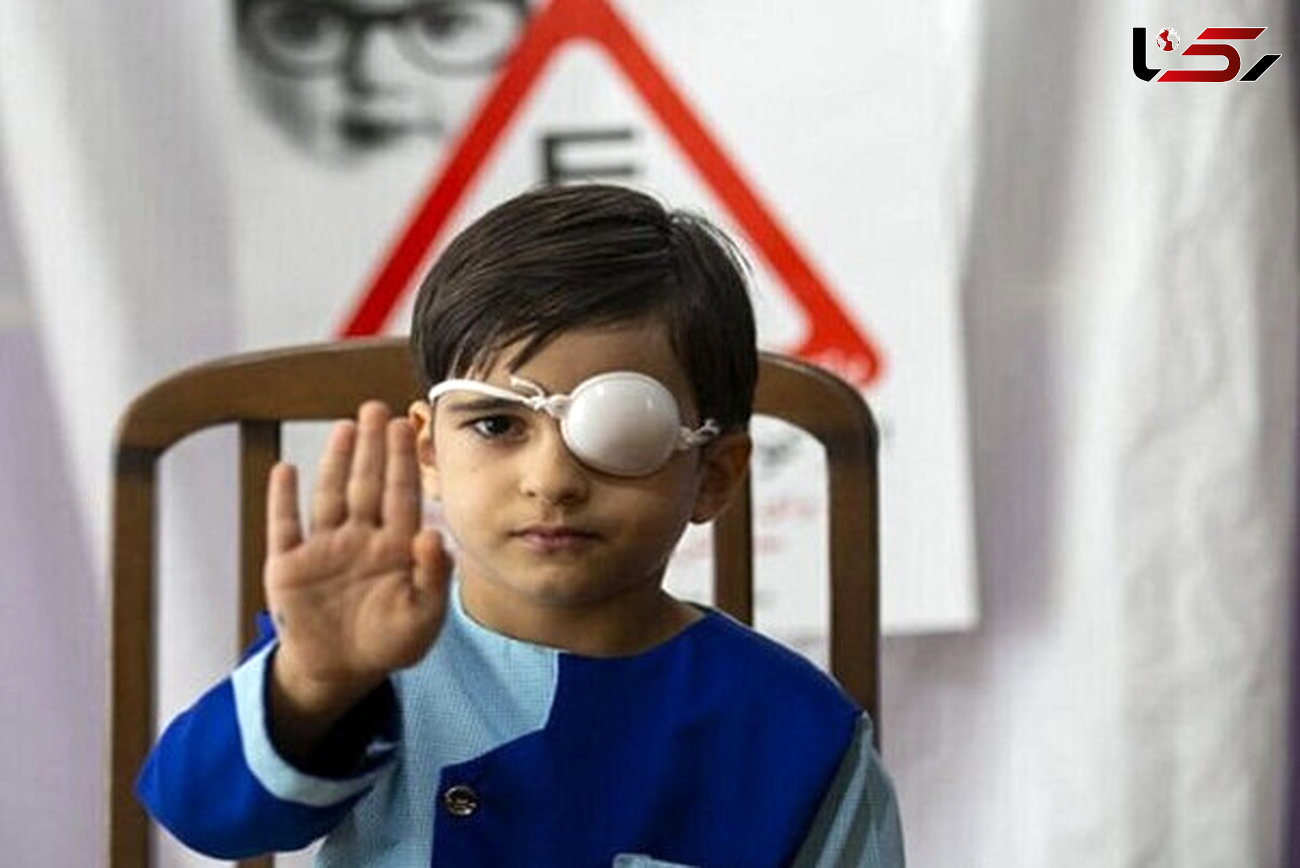 طرح پیشگیری از تنبلی چشم در ۶۸ پایگاه قزوین در حال اجراست