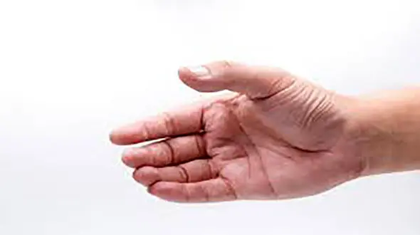 تشخیص بیماری ها از روی دست!