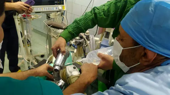 تلخ ترین عکس / چرخ شدن دست دختر 13 ماهه در چرخ گوشت خانگی / جوانرود

