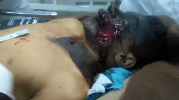 فوری / ​انفجار بمب در زابل + عکس 