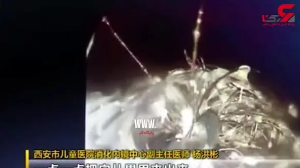 این دختر موهایش را می خورد! + فیلم