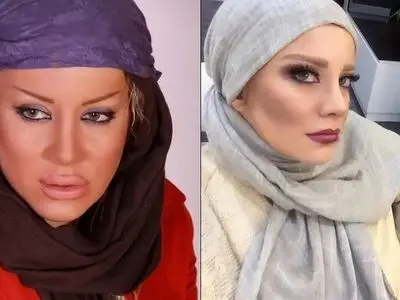 فیلم / شراره رخام: تزریق ژل لب بازیگری منو نابود کرد! ... / الان به سمت نچرال بودن گرایش دارم و...