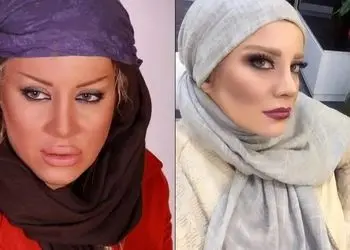 فیلم / شراره رخام: تزریق ژل لب بازیگری منو نابود کرد! ... / الان به سمت نچرال بودن گرایش دارم و...