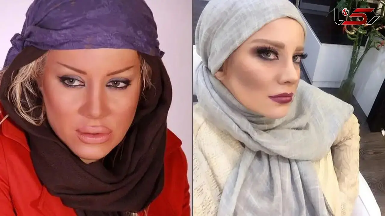 فیلم / شراره رخام: تزریق ژل لب بازیگری منو نابود کرد! / الان به سمت نچرال بودن گرایش دارم 