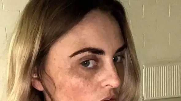 روش پلید این زن برای تامین هزینه جراحی بینی +عکس 