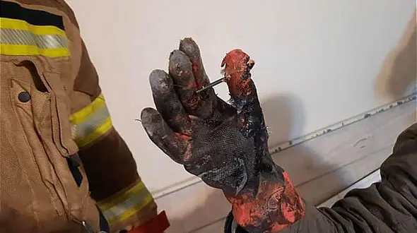 عکس تلخ / فرو رفتن مته در دست کارگر جوان تهرانی