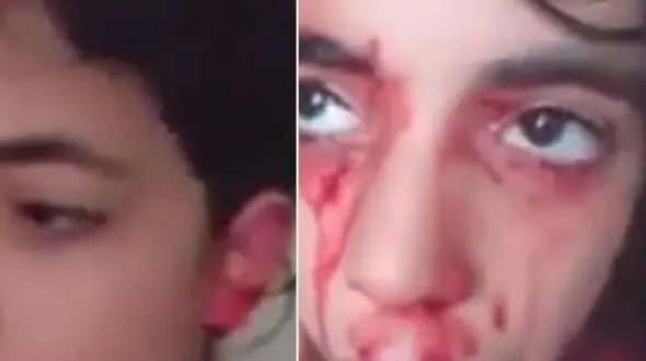 دختری که از  گوش‌ها و بینی اش خون گریه می‌کند + فیلم باورنکردنی