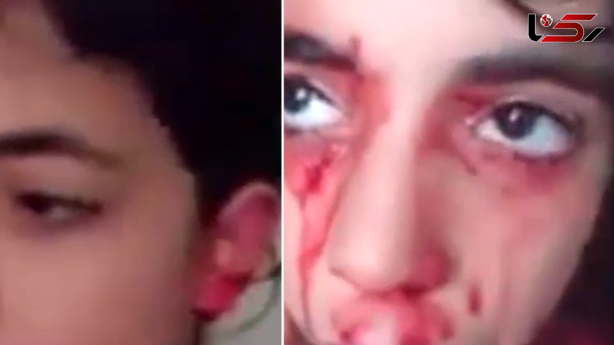دختری که از  گوش‌ها و بینی اش خون گریه می‌کند + فیلم باورنکردنی
