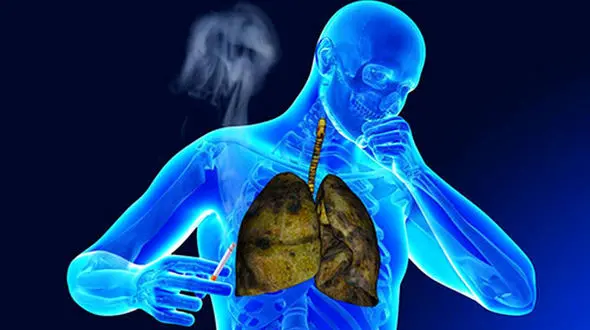 پاکسازی ریه‌ ها در هوای آلوده؛ راهکارهای سریع و کاربردی