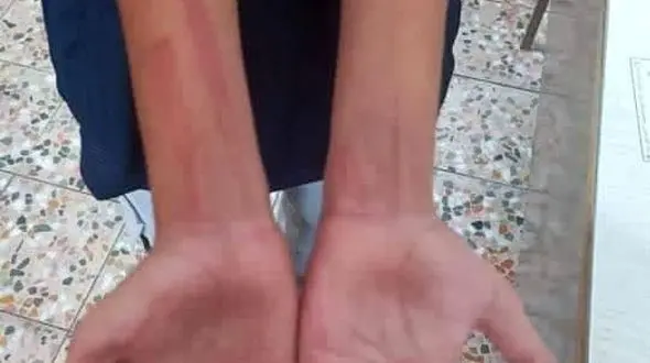 تنبیه یک دانش آموز در ایذه / رئیس آموزش و پرورش: در حال پیگیری هستیم