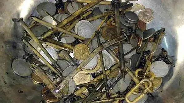 خارج کردن 413 شی فلزی از معده یک مرد + عکس
