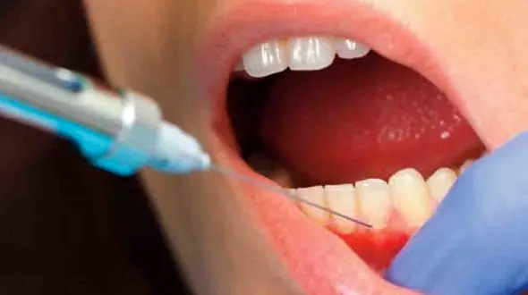 چرا بعضی از دندان‌ ها با آمپول بی‌ حسی بی‌ حس نمی‌شوند؟