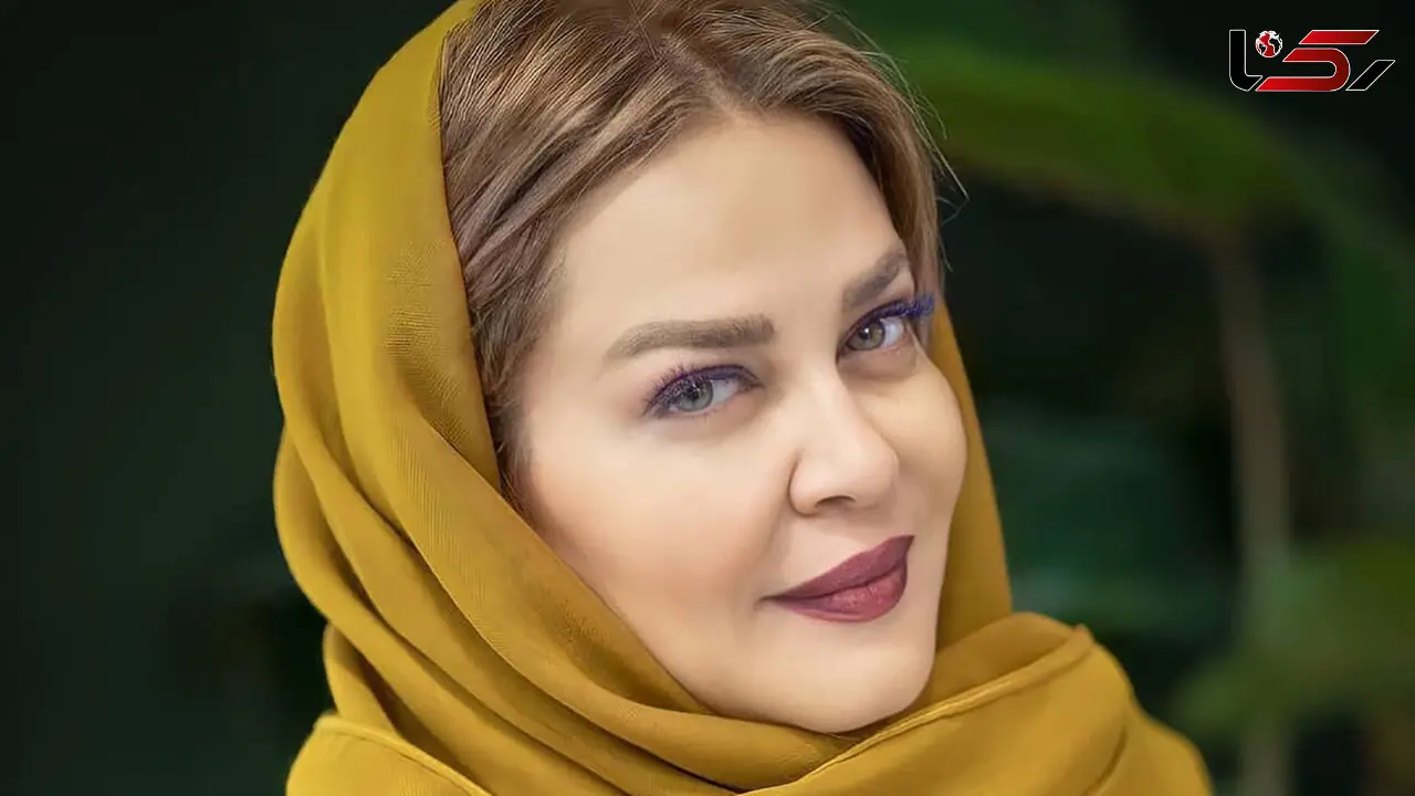 تزریق بیش از حد بهاره رهنما که لپاشو و لبشو از صورتش جدا شده