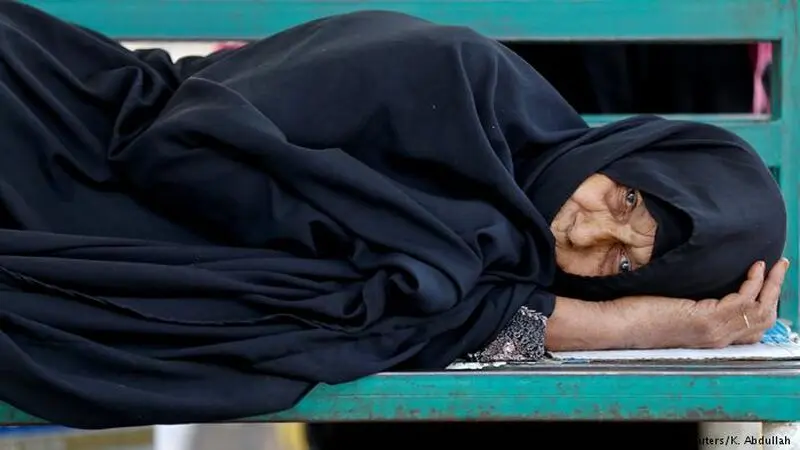 از قطع دست دختر یمنی به خاطر سرطان تا آوارگی پیرمردی با تومور مرگبار در دهان 