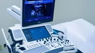 آمادگی پیش از سونوگرافی؛ از ناشتایی تا مدارک لازم