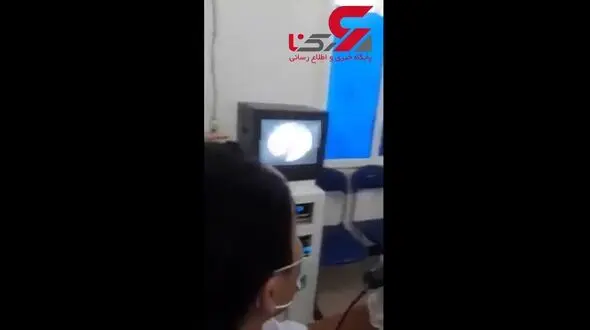ببینید در داخل بینی یک مرد چه موجودی زندگی می کرد+ تصویر