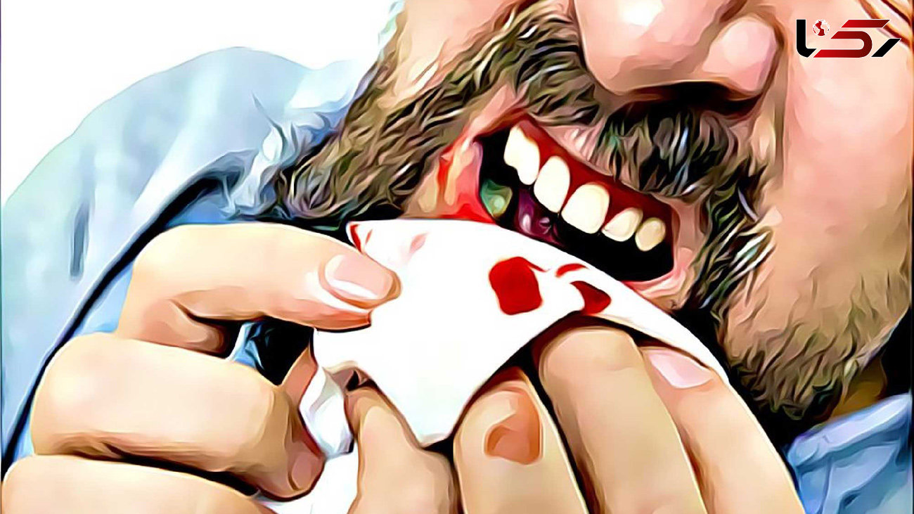 دلایل خونریزی لثه هنگام استفاده از نخ دندان