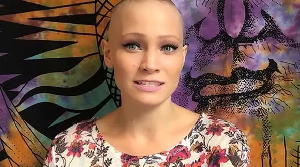 عروس کچل راز تلخی داشت ! / داماد چه کرد؟ + عکس / امریکا