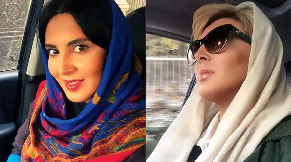 عکس های لیلا بلوکات قبل و بعد از عمل زیبایی بینی +عکس