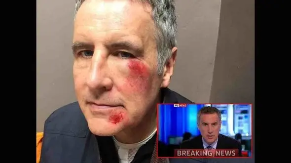 حمله سارقان دوچرخه به گوینده خبر تلویزیون+ عکس 