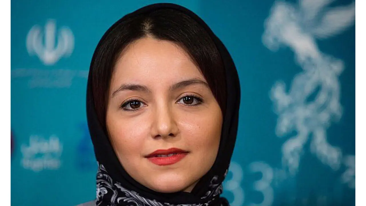 تغییر چهره وحشتناک  نازنین بیاتی بعد عمل زیبایی /  حیف چهره ملوسش !