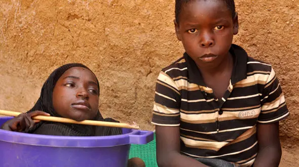 زندگی دردناک این دختر 19 ساله اشک تان را در می آورد/ عکس 14+