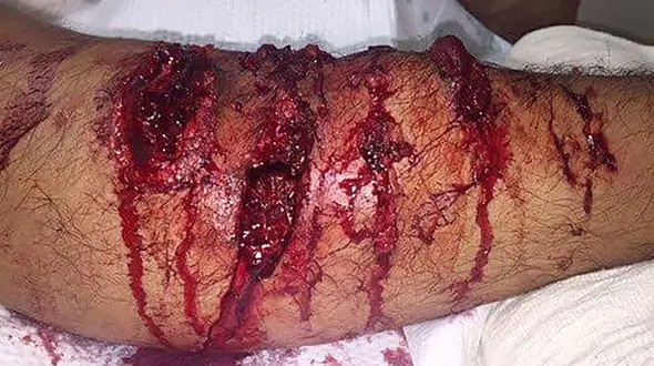 عکس 16 + / سگ ولگرد پای مرد تهرانی را درید 