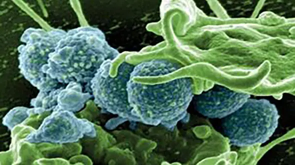 بیماری با علائم شبیه به کرونا آمده است / جزییات